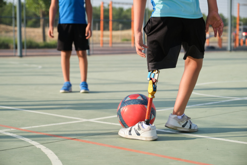 Audio – 3D printed arms and legs help kids play sports