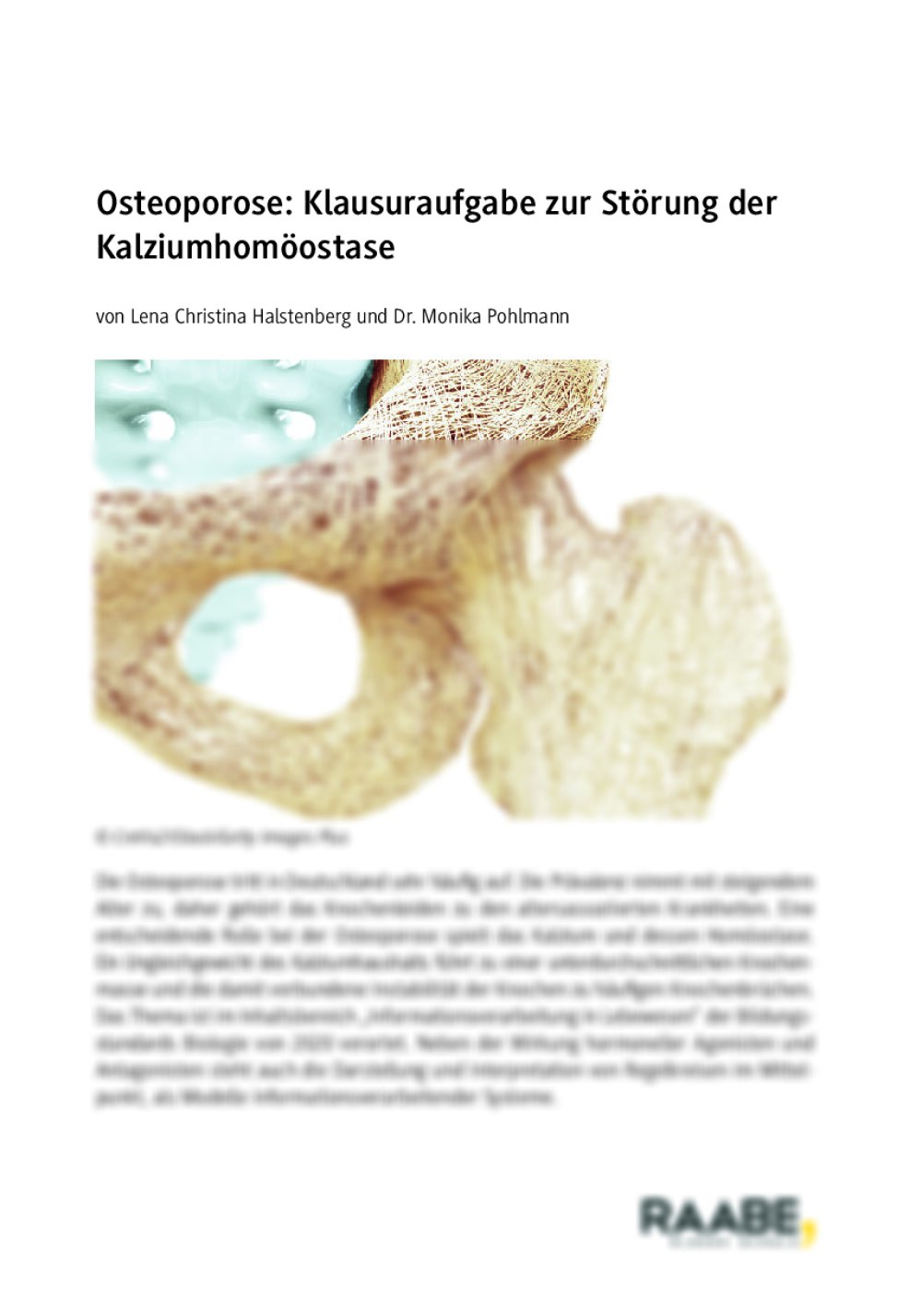 Osteoporose: Störung der Kalziumhomöostase - Seite 1