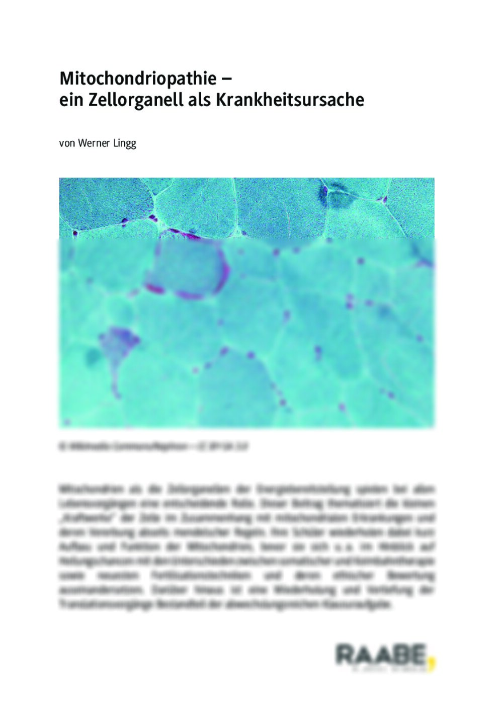 Mitochondriopathie - Seite 1
